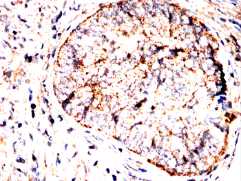 EP300 Antibody