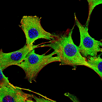 ACOT1 Antibody