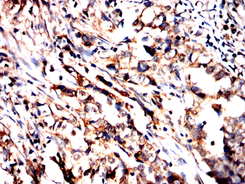 EP300 Antibody