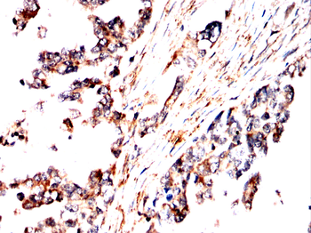 EP300 Antibody