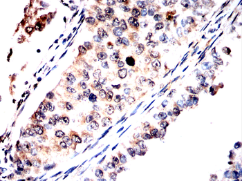 DSP Antibody