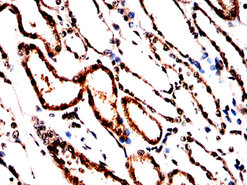 DSP Antibody