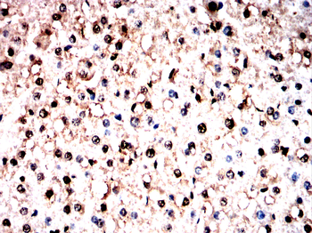 DSP Antibody