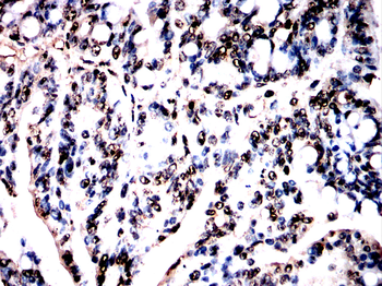 DSP Antibody
