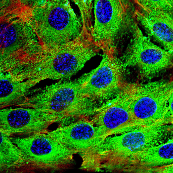 LUM Antibody