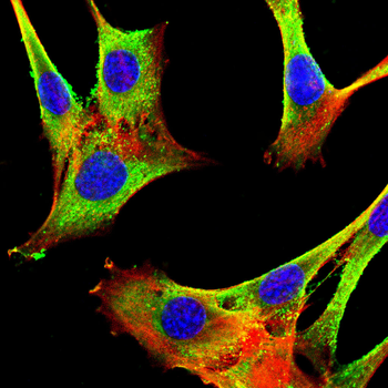 LUM Antibody