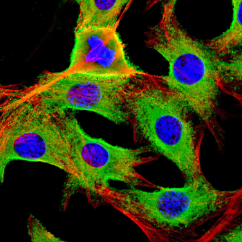 CXCL16 Antibody