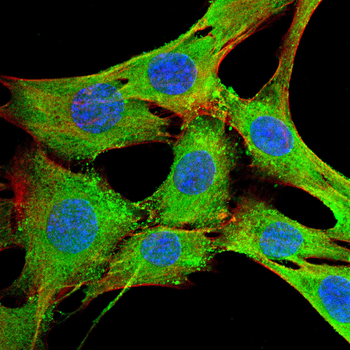 CXCL16 Antibody