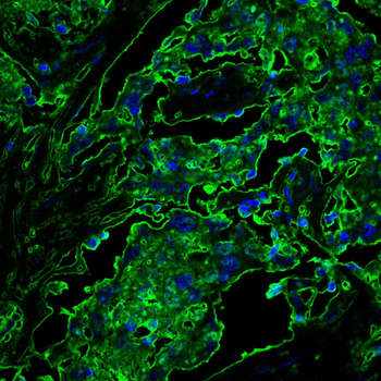 NOTCH1 Antibody