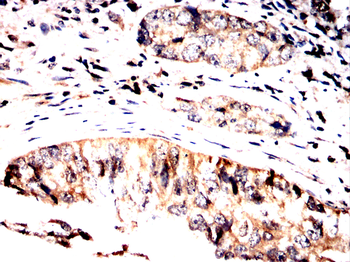 NOTCH1 Antibody