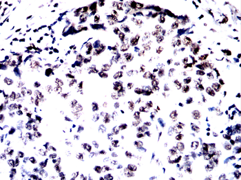 RARA Antibody