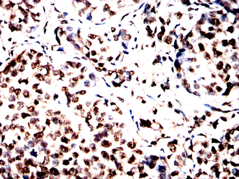 RARA Antibody