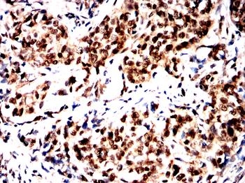 RARA Antibody