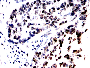 RARA Antibody