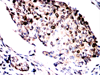 KDM6A Antibody