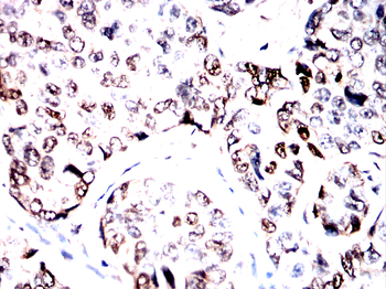 KDM6A Antibody