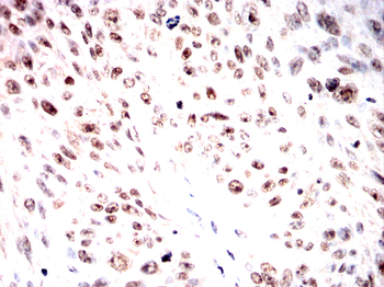 KDM6A Antibody