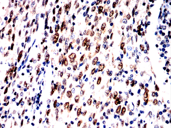 KDM6A Antibody