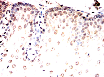 CRABP1 Antibody