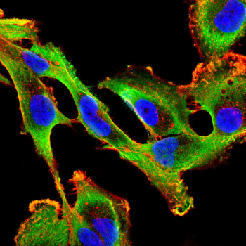 CXCL11 Antibody