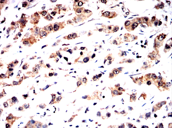 FTO Antibody