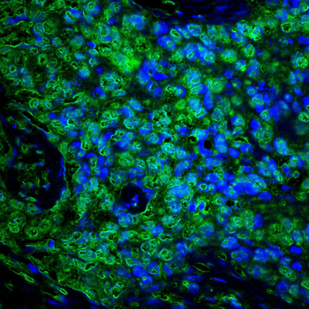 FTO Antibody