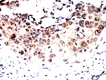 FTO Antibody
