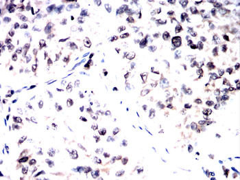 FTO Antibody