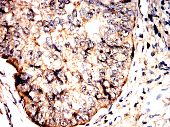 FTO Antibody