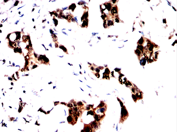 FTO Antibody