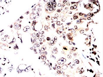 FTO Antibody