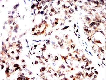 FTO Antibody