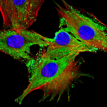 FGF7 Antibody