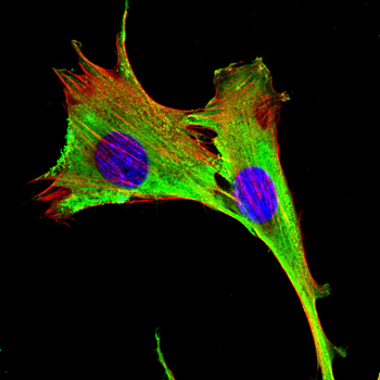 PNPLA2 Antibody