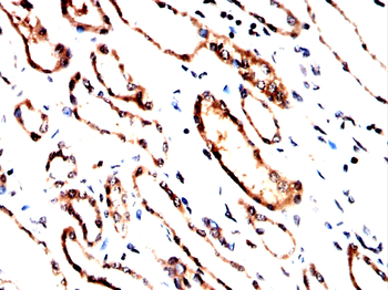 PNPLA2 Antibody