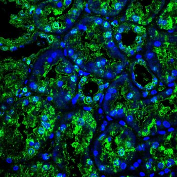 PNPLA2 Antibody
