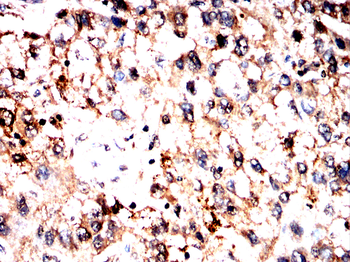 PNPLA2 Antibody