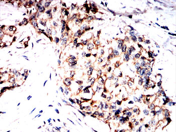 PNPLA2 Antibody