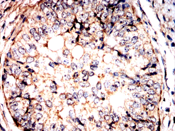 PNPLA2 Antibody