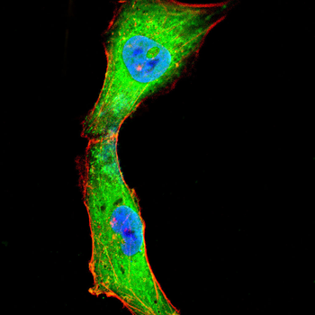 PNPLA2 Antibody