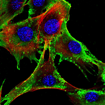 CPT1A Antibody