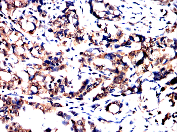 CPT1A Antibody