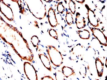 CPT1A Antibody
