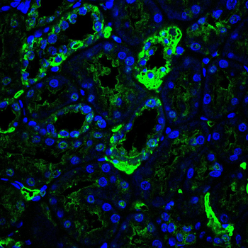 CPT1A Antibody