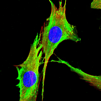 TOM1 Antibody