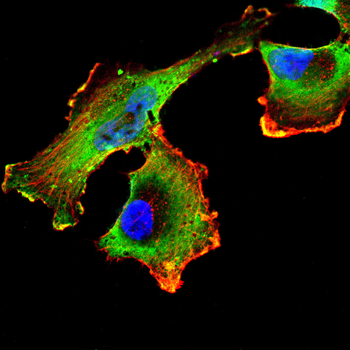 TOM1 Antibody