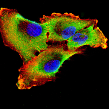 ITPR1 Antibody