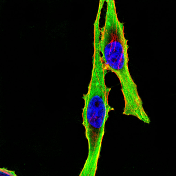 HTR3A Antibody