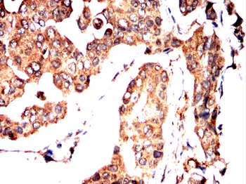 HTR3A Antibody