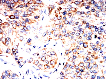 HTR3A Antibody